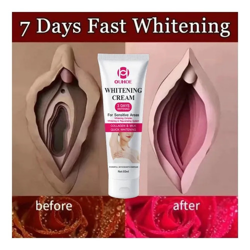 Clarinete Corporal De 3 Cremes Instantneo Para Áreas Íntimas