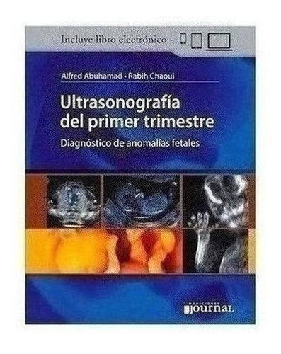 Ultrasonografía Del Primer Trimestre - Abuhamad, Alfred (pa