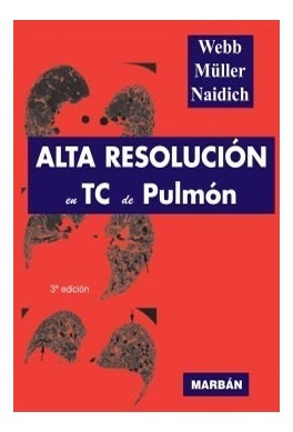 Webb Alta Resolucion Tc De Pulmon Libro Nuevo