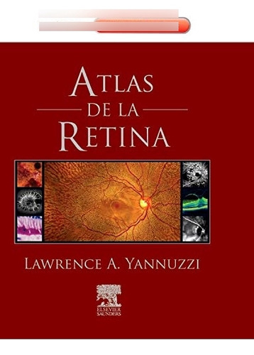 Libro Atlas De La Retina De Lawrence A. Yannuzzi Elsevier Es