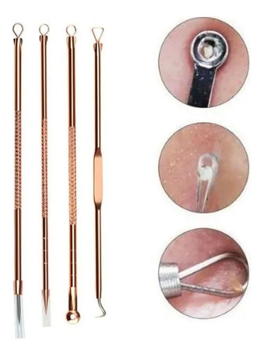 Kit Extrator De Cravos Profissional Removedor Acne Espinha
