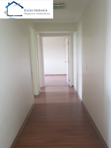 Imagem 17 de 30 de Apartamento - Ap01020 - 69394351