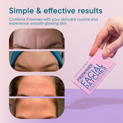Frownies Facial Pads, Use On Forehead And Between Eyes 144 E