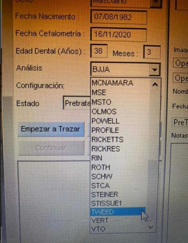 Software Premium Nemoceph Version 2006 Trazado Cefalométrico (Reacondicionado)