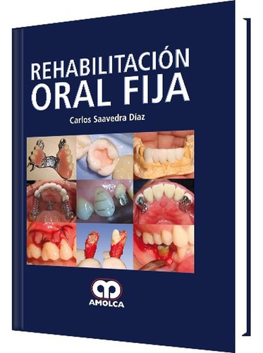 Rehabilitación Oral Fija