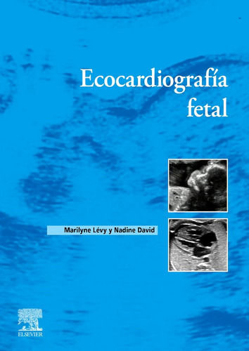 Ecocardiografia Fetal, De Levy. Editorial Elsevier, Tapa Blanda En Español