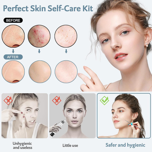 Menoly Kit De Herramientas Para Quitar Espinillas, 10 Piezas