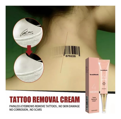Crema De Eliminación Permanente De Tatuajes* 3.