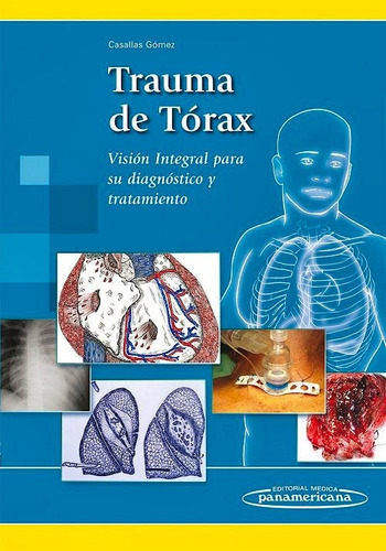 Casallas - Trauma De Torax