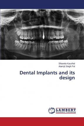 Libro Dental Implants And Its Design - Kaushal Shaveta