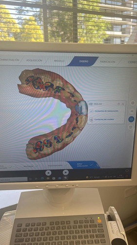 Scaner Cerec Omnicam 2017