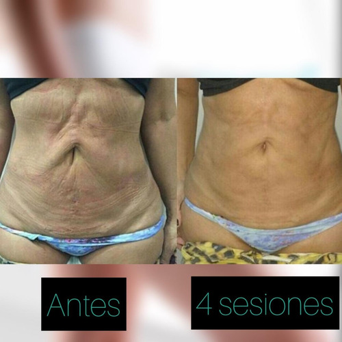 Imagen 3 de 10 de Alquiler Criofrecuencia/ Himfu Body Health 156 Veneri