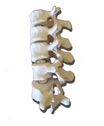 Vértebras Lumbares L1 A L5, Réplica Articulada En Plástico.