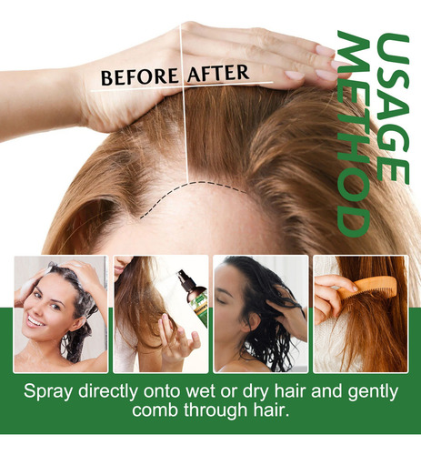 Eelhoe Aceite De Romero Set Tratamiento Para Cabello Seco