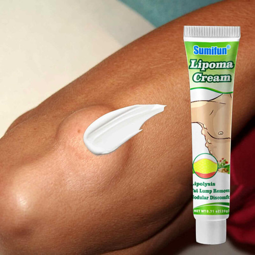 Creme De Eliminación De Lipoma Reduce, 20g, 4 Unidades