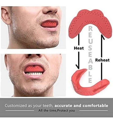 Imagen 2 de 6 de Uptthow 2pcs Reuseable Mouth Guard Sports Retainer For Adult