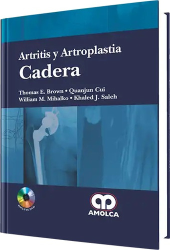 Artritis Y Artroplastia  Cadera Brown