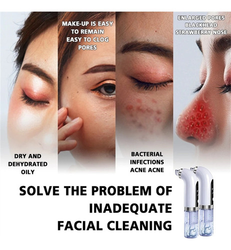 Dispositivo De Beleza Facial Com Sucção Para Remoção De