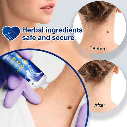 5 Peças De Creme De Remoção Instantânea De Manchas Removedor