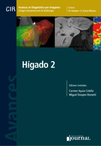 Avances En Diagnóstico Por Imágenes: Hígado 2  Ayuso