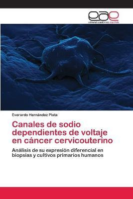 Libro Canales De Sodio Dependientes De Voltaje En Cancer ...