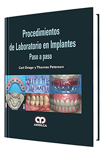 Libro Procedimientos De Laboratorio En Implantes De Carl Dra