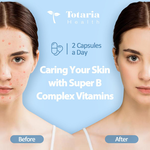 Complejo De Vitamina B Totaria 13 En 1 Con B1, B2, B3, B4, B