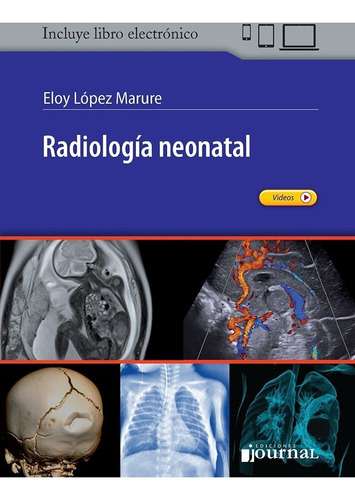 Radiología Neonatal  Ediciones Journal López Marure