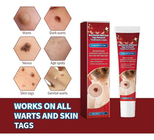 Crema Para Eliminar Verrugas De La Piel 20g