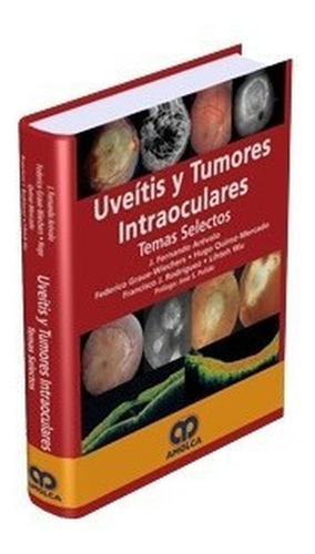 Uveítis Y Tumores Intraoculares