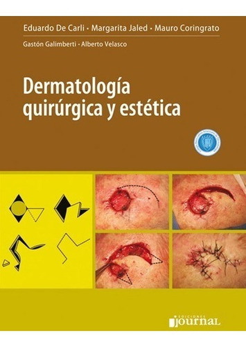 Dermatologia Quirurgica Y Estetica