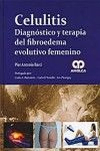 Celulitis. Diagnóstico Y Terapia Del Fibroedema Evolutivo Fe