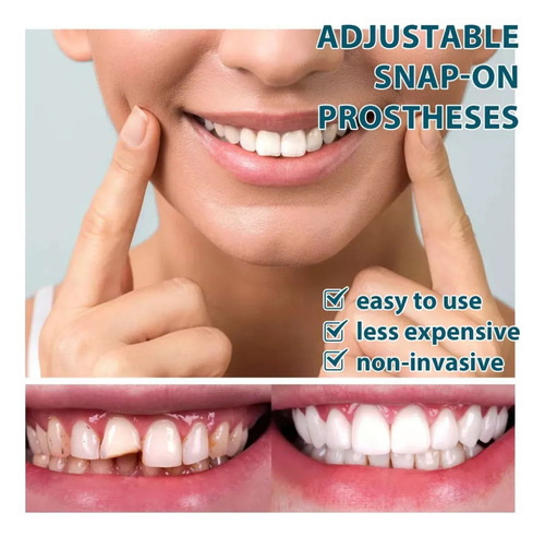 Soportes De Montaje Ajustables Para Dentaduras Temporales