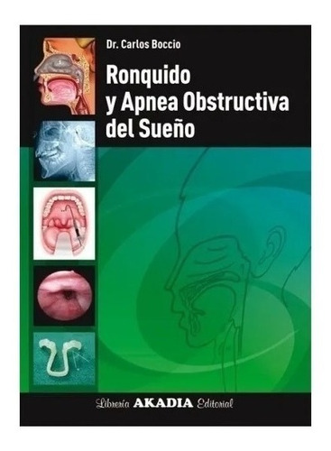 Ronquido Y Apnea Obstructiva Del Sueño Boccio Nuevo!