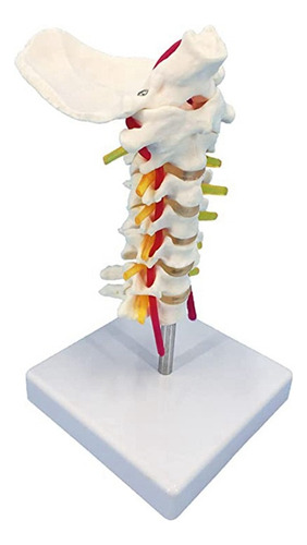 Modelo De Columna Cervical Con Nervios, Vértebra Cervical De