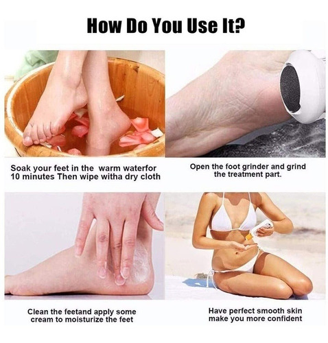 1pcs Pedicure Tool Pé Calo Removedor Cuidados Esfoliação