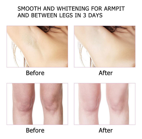 Crema Aclarante Whitening Cream Axilas
