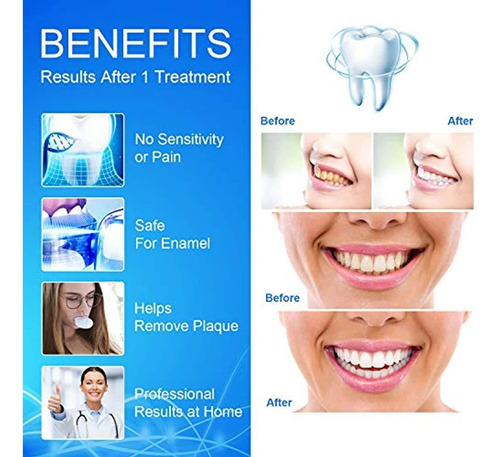 Kit De Blanqueamiento De Dientes Con Bandeja De Luz Led
