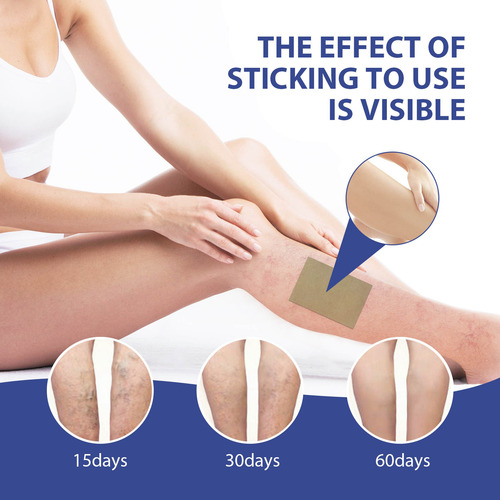 L Varicose Vein Patch Varicose Vein Patch Spider Vein Legs S