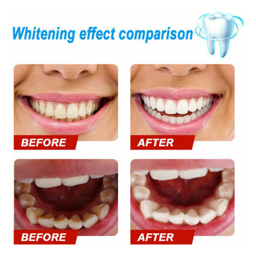 Esencia Blanqueadora Dental Efero Limpeza Higiene Oral Remov