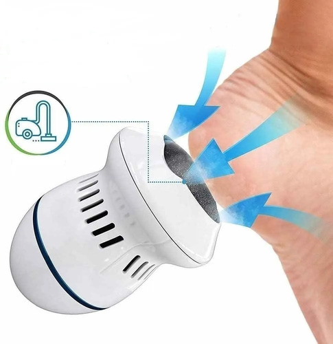 Imagem 4 de 7 de Esfoliador De Calos Elétrico Para Pés Usb Sugador De Resíduo