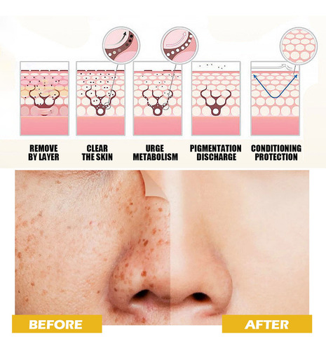 Tônico Para Cúrcuma Escura, Corretor Escuro, Tônico Facial F