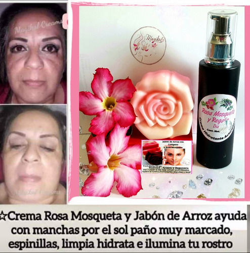 1. Manchas,paño Rosa Mosqueta, 1.efecto Botox Anti Arrugas