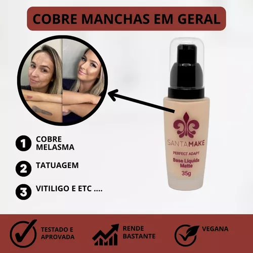 Base Matte Alta Cobertura Vitiligo Esconder Manchas A Melhor