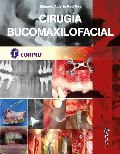 Cirugía Bucomaxilofacial E. Rey Corpus Edición Premium