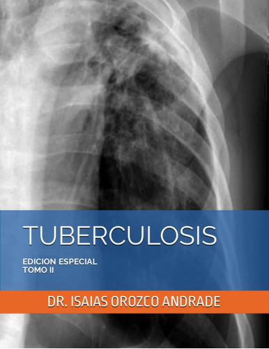 Libro: Tuberculosis: Edicion Especial. Tomo Ii (tuberculosis