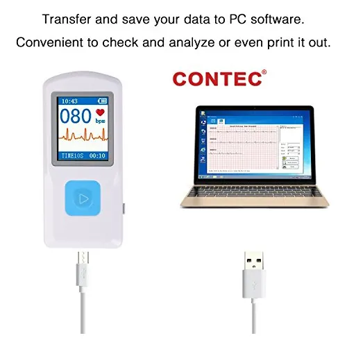 Contec Ecgekg Monitor Portátil Software De Pc Electrocardiog