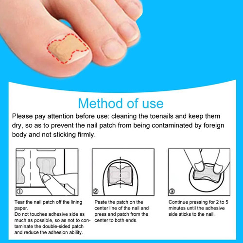 Corrector De Uñas Encarnadas De Pegatinas Viscosidad 120pz