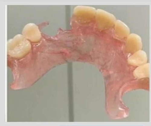 Imagen 5 de 5 de Protesis Flexibles