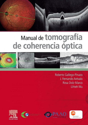 Libro: Manual De Tomografía De Coherencia Óptica. Vv.aa.. El